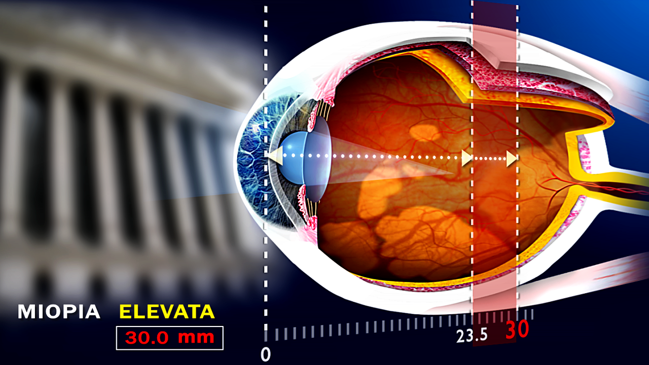 viziunea manichiuristului vitamine pentru ochi atunci când vederea scade