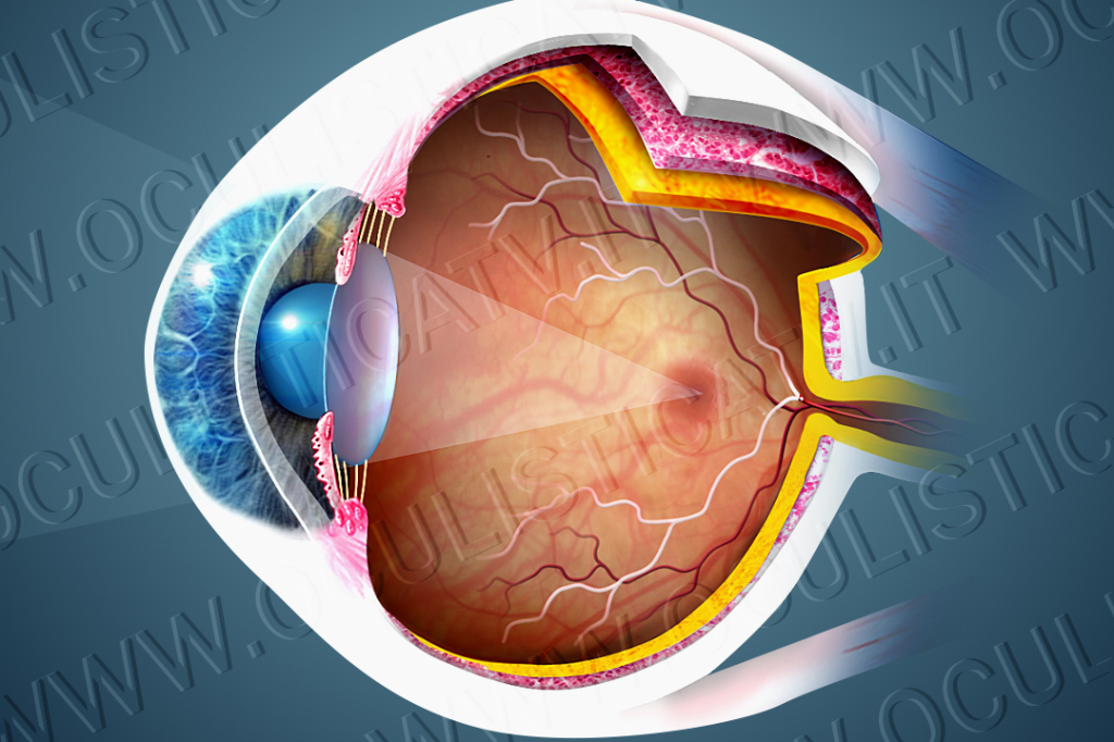 Diagnosi dell’occlusione dell’arteria retinica centrale
