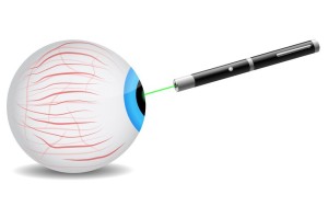 Occhio laser